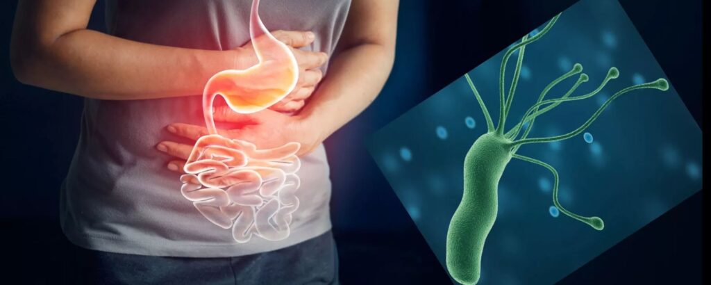 Осем изненадващи факта за СТОМАХА 7 helicobacter pylori
