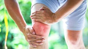 Top 5 Sources Vitamins Supplements for Healthy Joints Keep Fit Kingdom 842x472 1