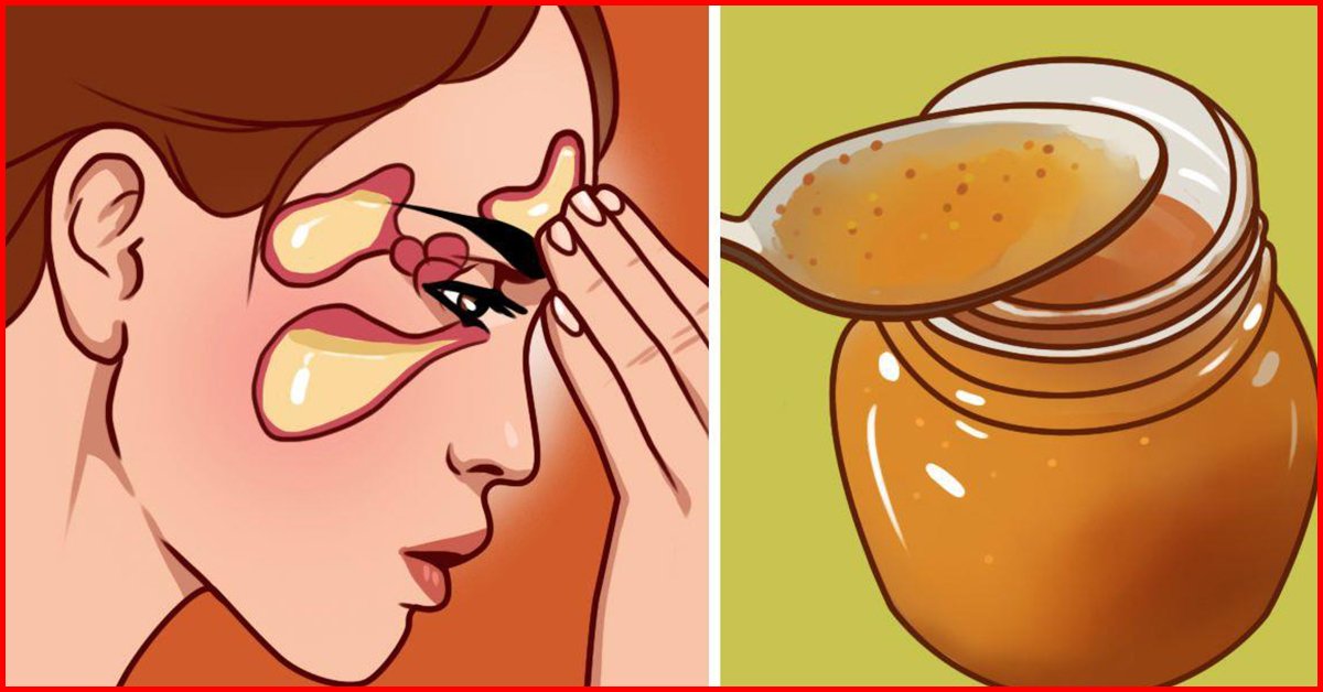 10 Effective Home Remedies For Sinusitis 2